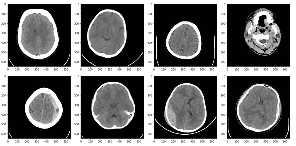Eight grayscale axial CT slices arranged in two rows.